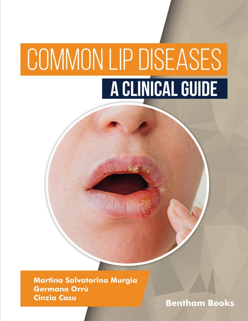 Common Lip Diseases: A Clinical Guide 1st Edition