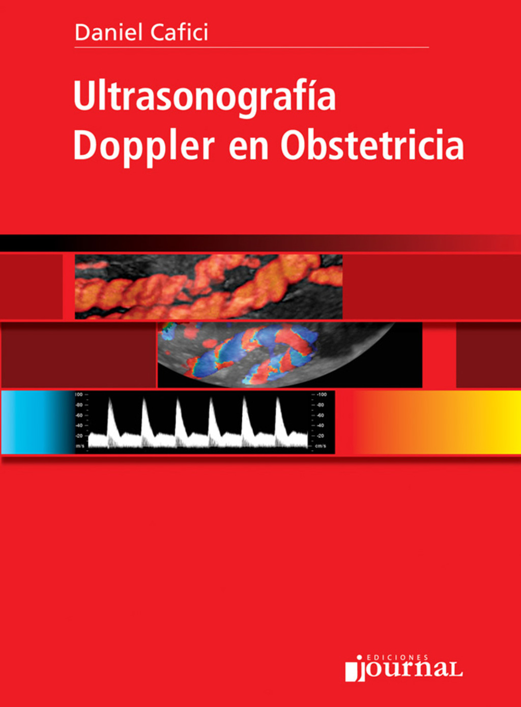 UltrasonografÃƒÂ­a Doppler en Obstetricia 1st Edition