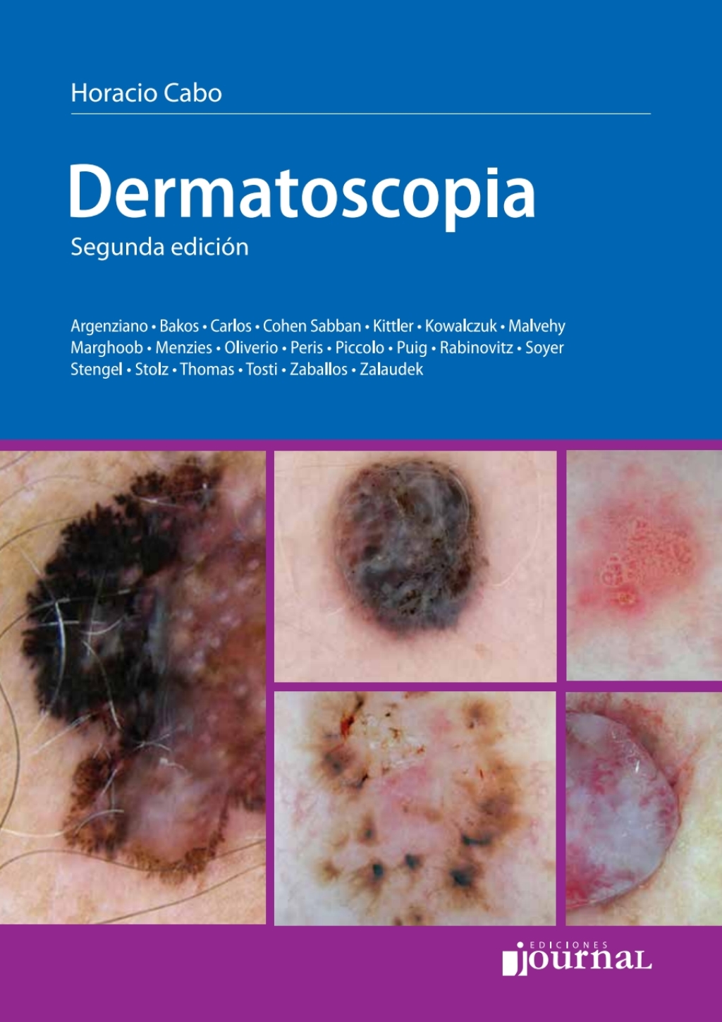 DermatoscopÃƒÂ­a 2nd Edition