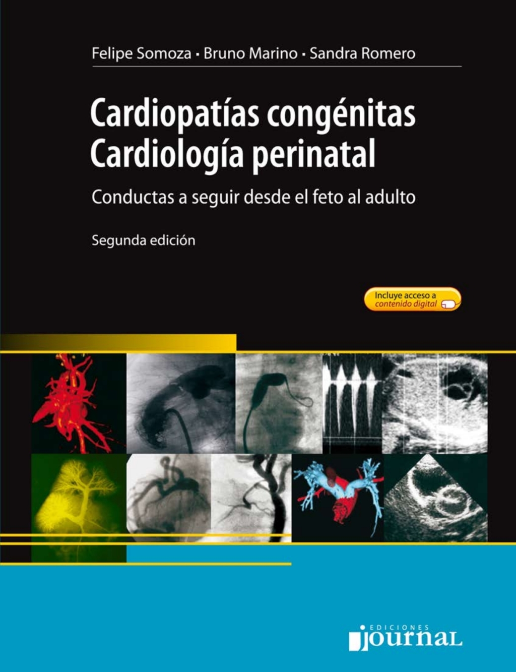 CardiopatÃƒÂ­as congÃƒÂ©nitas, cardiologÃƒÂ­a perinatal: Conductas a seguir desde el feto al adulto. 1st Edition