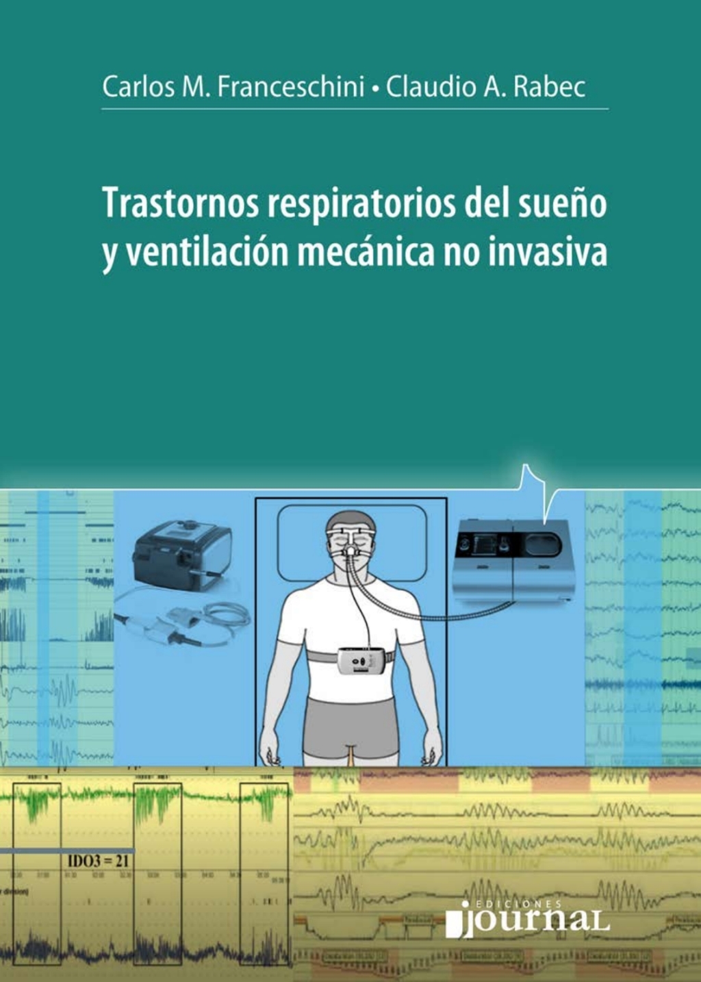 Trastornos respiratorios del sueÃƒÂ±o y ventilaciÃƒÂ³n mecÃƒÂ¡nica no invasiva 1st Edition