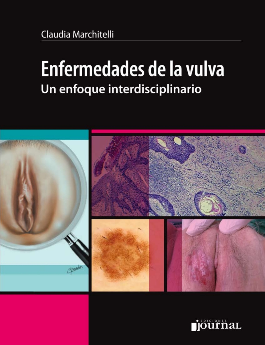 Enfermedades de la vulva 1st Edition