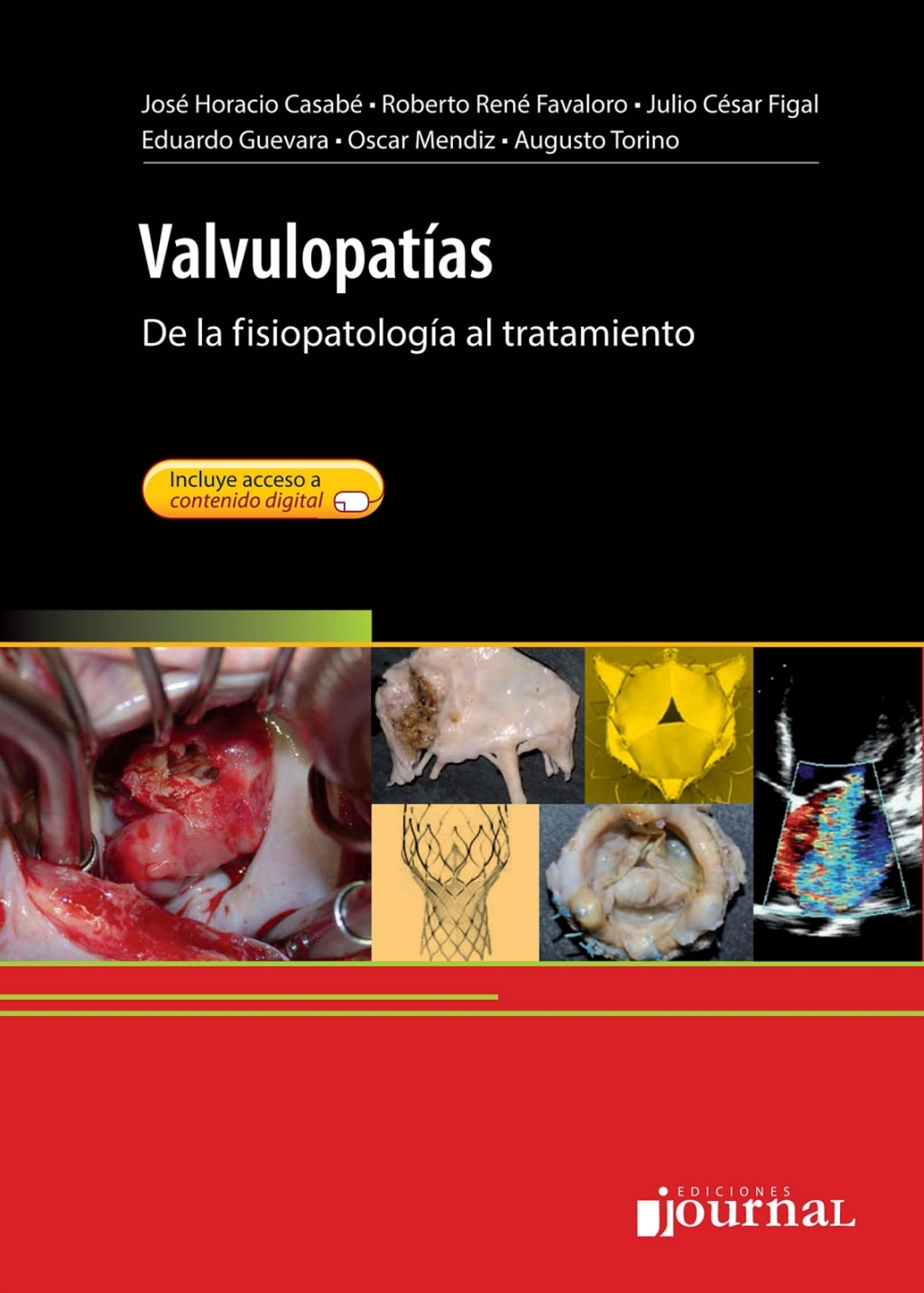 ValvulopatÃƒÂ­as 1st Edition