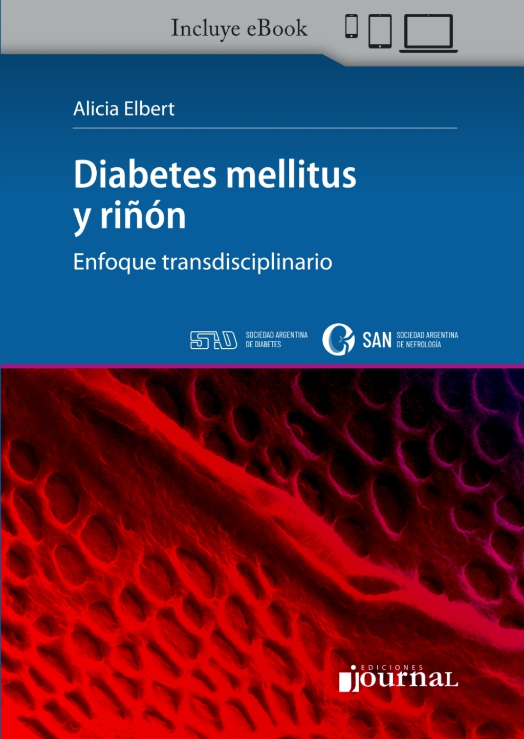 Diabetes mellitus y riÃƒÂ±ÃƒÂ³n 1st Edition