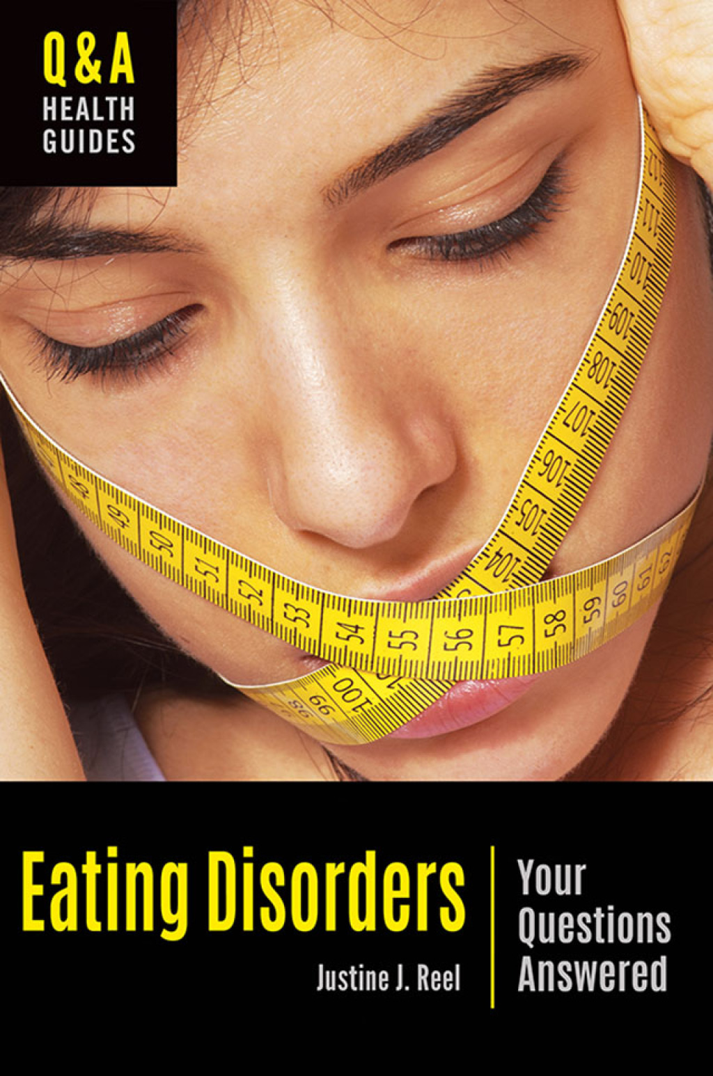 Eating Disorders Your Questions Answered 1st Edition