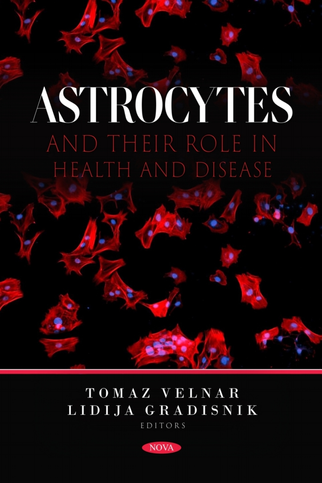 Astrocytes and Their Role in Health and Disease 