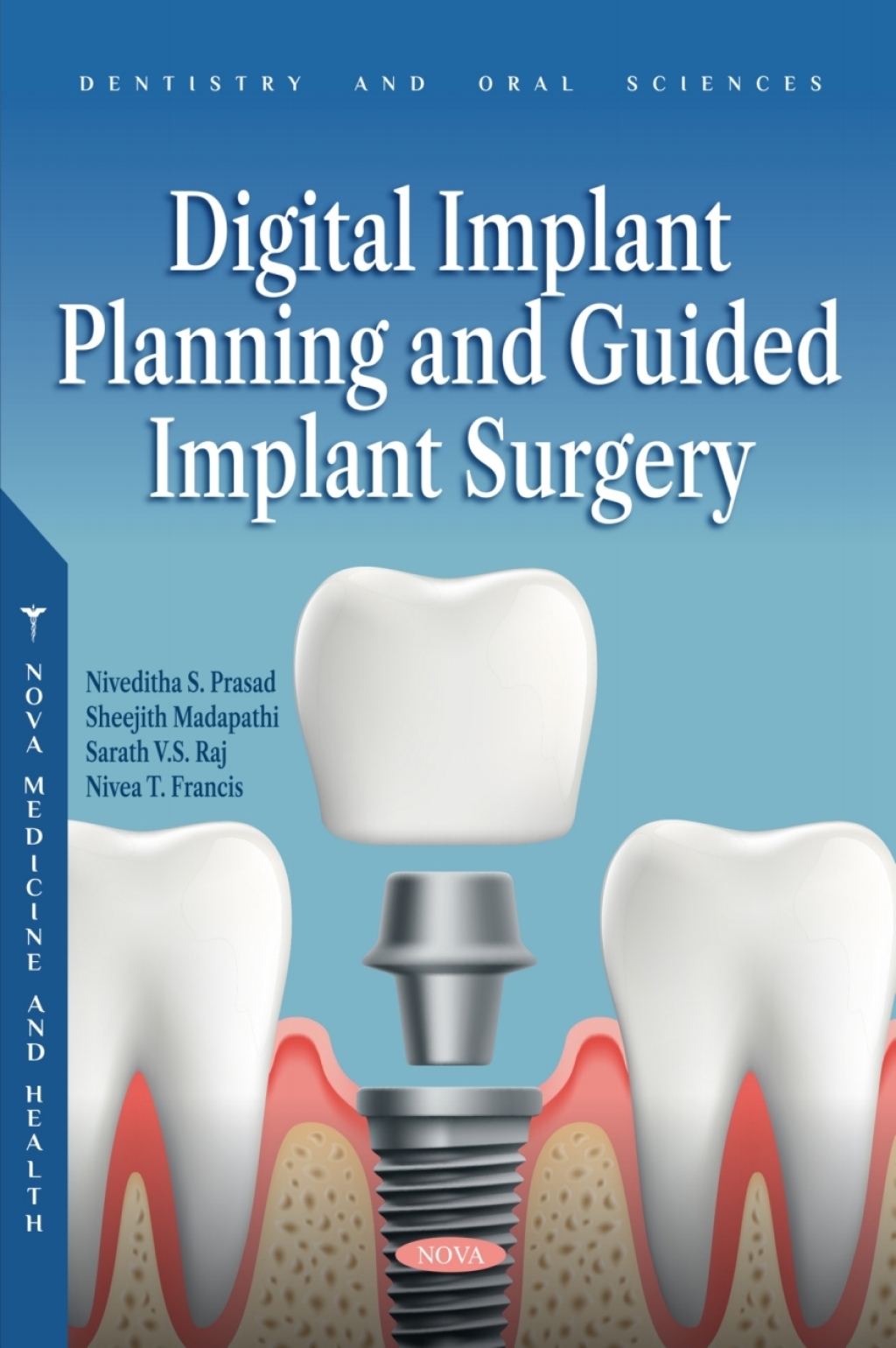 Digital Implant Planning and Guided Implant Surgery 