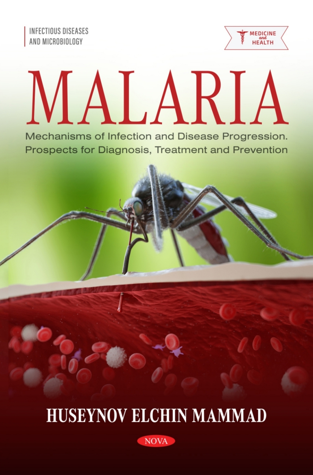 Malaria: Mechanisms of Infection and Disease Progression. Prospects for Diagnosis, Treatment and Prevention 